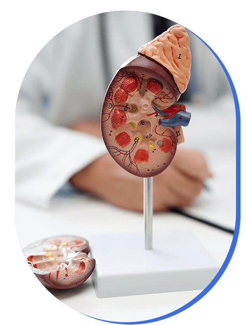 diagnostico-de-patologia-renal.png