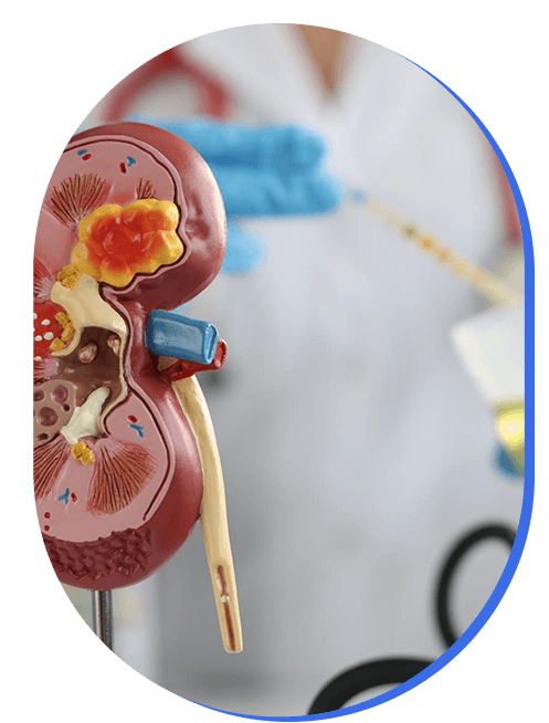 manejo-de-hematuria.png