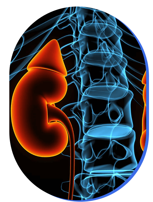 manejo-integrado-de-la-enfermedad-renal.png