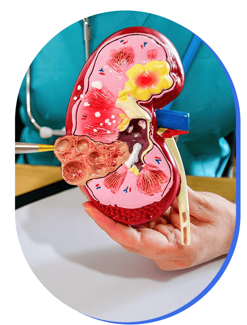 nefrologo-cerca.png