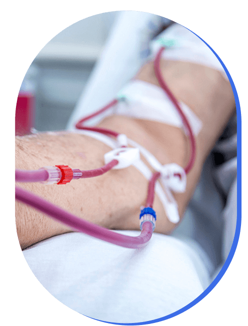terapia-de-hemodialisis.png